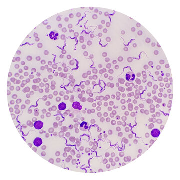 Trypanosoma sp. among red blood cells. Trypanosome species in blood from cattle.  Trypanosoma is a protozoan parasite that is the causative agent of the animal disease trypanosomiasis or &lsquo;Surra&rsquo;