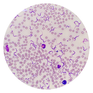 Trypanosoma sp. among red blood cells. Trypanosome species in blood from cattle.  Trypanosoma is a protozoan parasite that is the causative agent of the animal disease trypanosomiasis or ‘Surra’