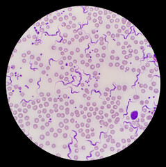 Trypanosoma sp. among red blood cells. Trypanosome species in blood from cattle.  Trypanosoma is a protozoan parasite that is the causative agent of the animal disease trypanosomiasis or ‘Surra’