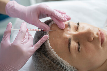 Close-up real process of the hands of an expert cosmetologist injecting botox into a woman's forehead. Correction of forehead and eye wrinkles with botulinum toxin.