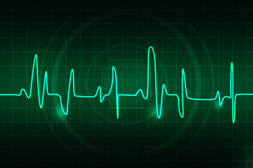 Cardiogram concept -2D rendering illustration