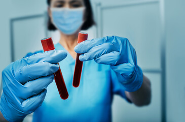 Blood sample tubes with blood infected Monkeypox virus in laboratory assistant hands, close-up