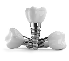 dental implants isolated on a white background.3D rendering - 509661529