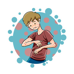 young boy suffering from chicken pox