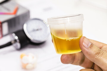 hand holding urine pot or bottle, delivering urine for medical examination for hypertension diagnosis