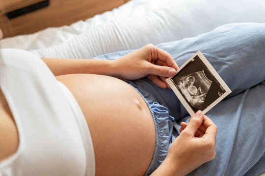 Ultrasound photo pregnancy baby. Woman holding ultrasound pregnant picture. Concept maternity, pregnancy, childbirth.