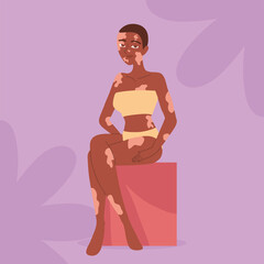 young woman with vitiligo pigmentation