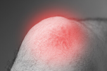 Fototapeta premium knee injury in humans .knee pain,joint pains people medical, mono tone highlight at knee 
