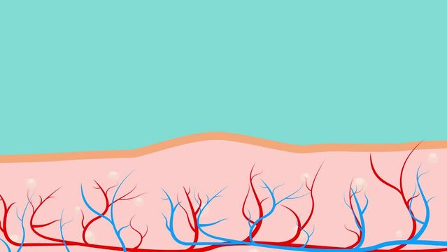 Acne and Pimples disappear on skin graphic animation.