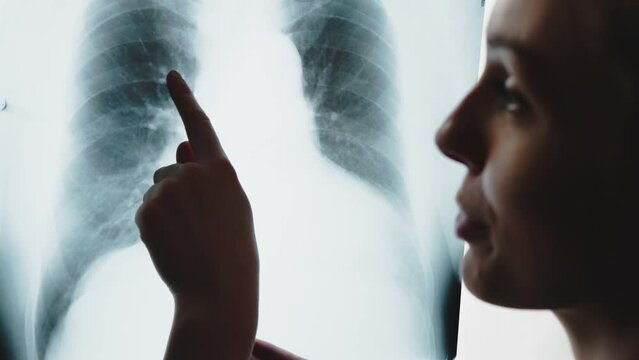 Closeup portrait of a caucasian female radiologist doctor explaining everything to the patient by pointing to their lung's x-ray. High quality 4k footage