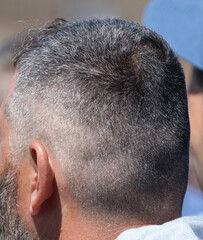 Gray hair on the head of a man.