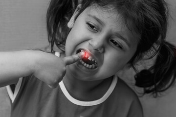 Little caucasian girl in a red dress shows pain in her tooth and mouth