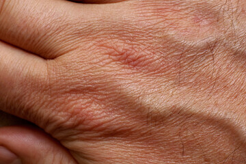 close-up of a man's hand detail
