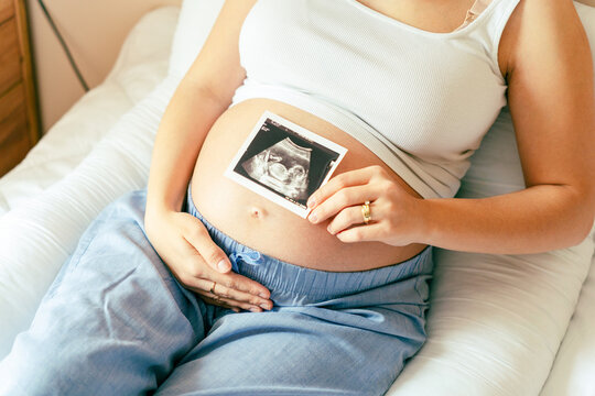 Ultrasound picture pregnant baby photo. Woman holding ultrasound pregnancy image. Concept of pregnancy, maternity, expectation for baby birth.