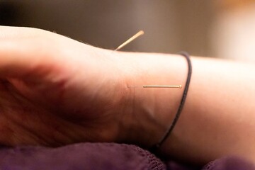 A portrait of a few thin acupuncture needles just below the wrist, put in place by an acupuncturist. This alternative medicine treatment is used for healing, stimulation, relaxing and stress relief. - obrazy, fototapety, plakaty