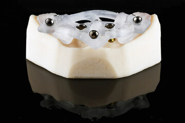 surgical template dental for implantation of the lower jaw on a model with a black background