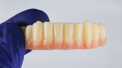 milled dental prosthesis of the lower jaw with artificial gum on a white background