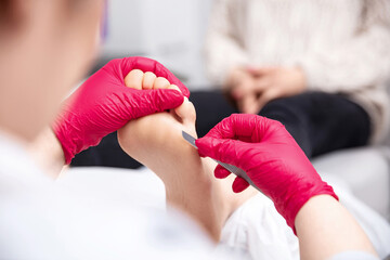 Medical pedicure procedure using special instrument with blade knife holder.