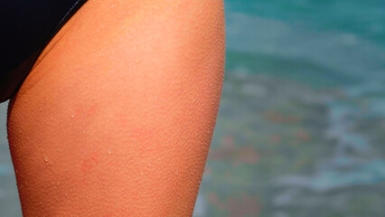 Caucasian woman having chills on skin on cold and windy summer day. Goosebumps on on a woman thighs on freezing day at seashore. Close up skin.