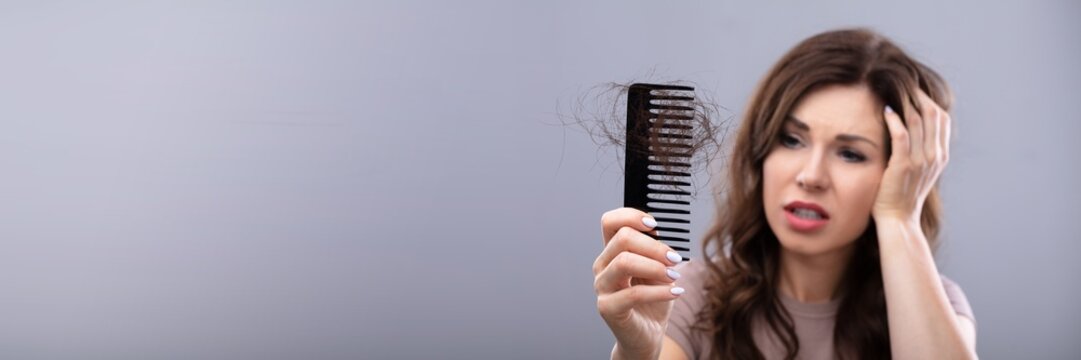 Worried Woman Suffering From Hairloss