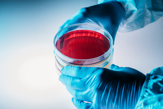 Lab researcher working with petri dishes