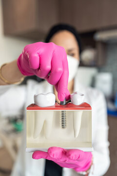 Dentist with dental implant model