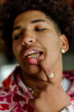Young man reveals gold teeth