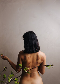 Bare back covered in cupping marks