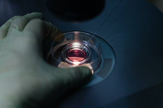 IVF procedure in petri dish in lab