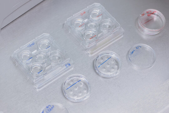 IVF procedure in petri dish in lab