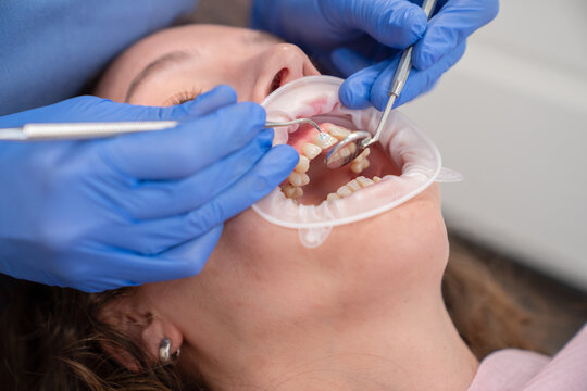 Dentist Hands Adjusting Brackets To Patient