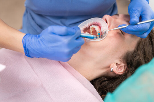 Anonymous Dentist Adjusting Brackets To Patient