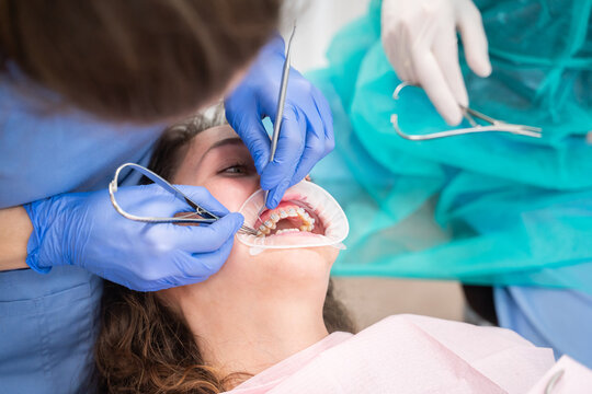 Orthodontic Treatment. Adjusting Ceramic Braces
