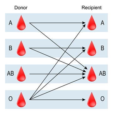 Recipient and Donor. Types of blood