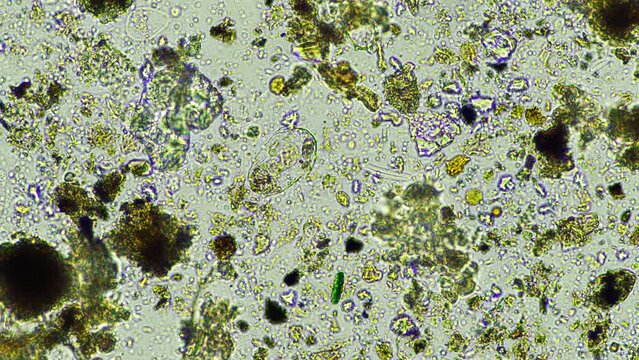 soil microorganisms nematode, microarthropods, micro arthropod, tardigrade, and rotifers a soil sample, soil fungus and bacteria on a regenerative farm in compost. Science under the microscope