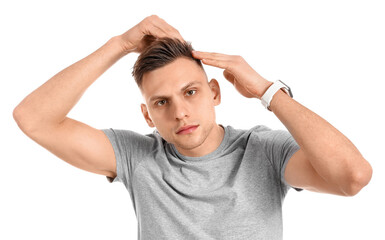 Young man with hair loss problem on white background