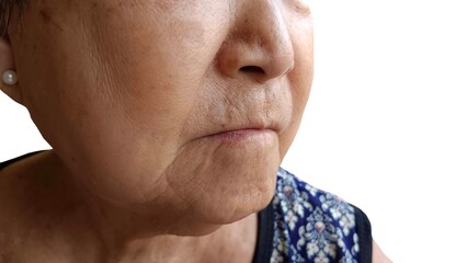 An old woman has wrinkles on her face.
