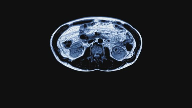 Voluminous color CT scan of the abdomen. Computed tomography of the gastrointestinal tract, liver and kidneys