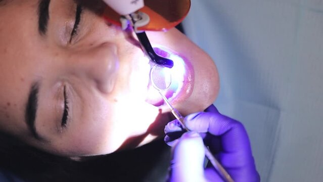 Tooth restoration with filling and polymerization lamp. Dental curing light 