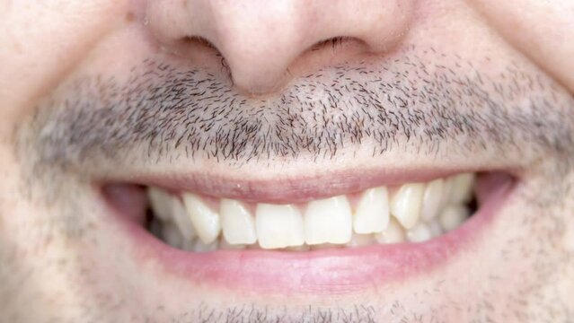 young bearded man with small teeth is smiling to the camera,close up 4k video of mouth.dental care concept,dentist,doctor.teeth care,treatment.