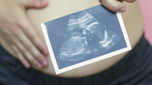 pregnant woman holding ultrasound picture of fetus in one hand and touching,caress, belly with another.pregnancy and health concept. new life, new baby birth. fetus in tummy,unborn yet baby.motherhood