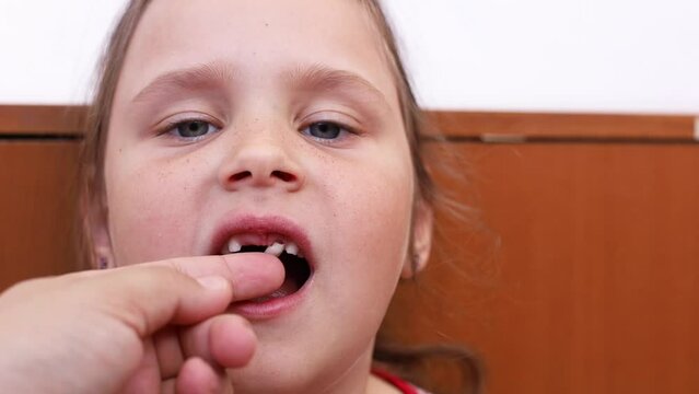 Little girl face looking at camera with baby gingival teeth problem. Cropped hand shaking primary milk tooth. Help to remove milk tooth with hand, fell out. Dental care, dentist treatment, healthcare