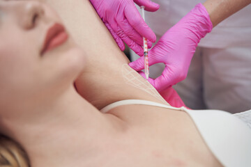 Female client is getting armpit injections to prevent excessive sweating