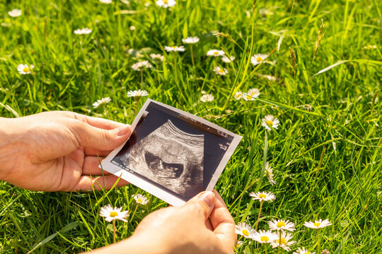 Ultrasound photo pregnancy baby. Woman holding ultrasound pregnant picture on grass flower background. Concept maternity, pregnancy, childbirth.