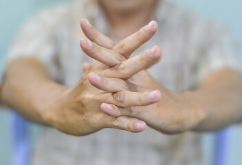 Hand of Asian elder man. Concept of rheumatoid arthritis, osteoarthritis, or joint pain