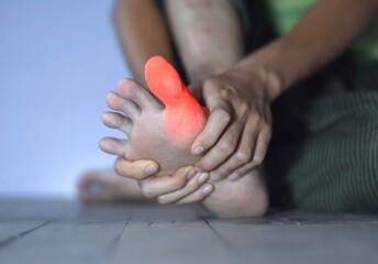 Inflammation of Asian man’s big toe. Concept of foot joint pain, stumble, arthritis, hyperuricema...