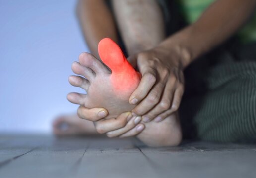 Inflammation of Asian man&rsquo;s big toe. Concept of foot joint pain, stumble, arthritis, hyperuricema or gout.