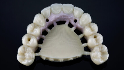 dental prosthesis of the upper jaw without processing technique, top view on a black background © Dental Pro Content
