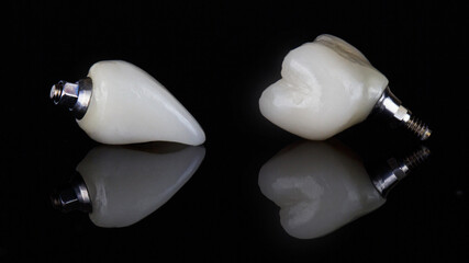 two ceramic crowns of the central and posterior teeth on black glass with reflection