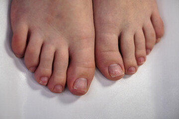 Obraz na płótnie Canvas Pedicure on female feet close-up. Procedures in a beauty salon.